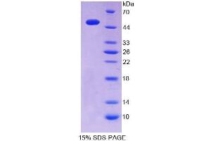 SDS-PAGE analysis of Mouse ITPA Protein. (ITPA 蛋白)