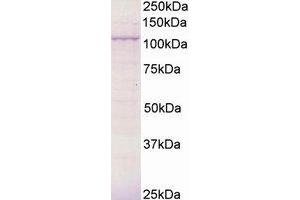 Image no. 1 for anti-Breast Cancer Anti-Estrogen Resistance 3 (BCAR3) (AA 813-825) antibody (ABIN292889) (BCAR3 抗体  (AA 813-825))