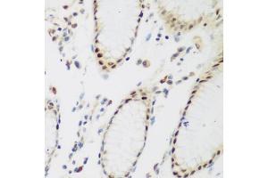Immunohistochemistry of paraffin-embedded human stomach using PPAN antibody (ABIN5975126) at dilution of 1/200 (40x lens). (PPAN 抗体)