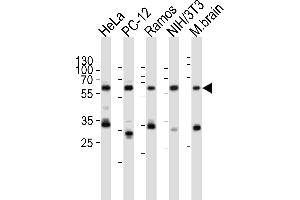 Western blot analysis of lysates from HeLa, rat PC-12, Ramos, mouse NIH/3T3 cell line, mouse brain tissue lysate(from left to right), using PKM2-N491 at 1:1000 at each lane. (Pyruvate Kinase 抗体  (C-Term))