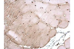 Immunohistochemistry (IHC) image for anti-Excision Repair Cross-Complementing Rodent Repair Deficiency, Complementation Group 6 (ERCC6) (Internal Region) antibody (ABIN2855858)