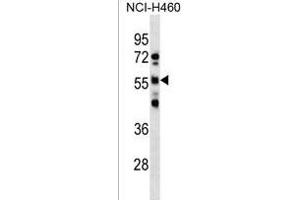 Western Blotting (WB) image for anti-RNA Binding Motif Protein, Y-Linked, Family 1, Member D (RBMY1D) (AA 444-470), (C-Term) antibody (ABIN1537343)