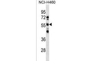 RBMY1D Antibody (C-term) (ABIN1537343 and ABIN2850417) western blot analysis in NCI- cell line lysates (35 μg/lane). (RBMY1D 抗体  (C-Term))