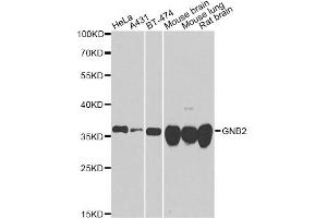Western blot analysis of extracts of various cell lines, using GNB2 antibody. (GNB2 抗体)