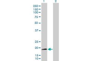 Western Blot analysis of NNT expression in transfected 293T cell line by NNT MaxPab polyclonal antibody. (NNT 抗体  (AA 1-207))