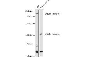 Western blot analysis of extracts of various cell lines, using Insulin Receptor antibody (ABIN3020883, ABIN3020884, ABIN3020885 and ABIN6213774) at 1:1000 dilution. (Insulin Receptor 抗体  (AA 1130-1230))