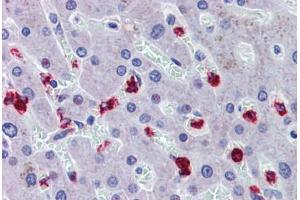 Liver, Human: Formalin-Fixed, Paraffin-Embedded (FFPE) (RASSF2 抗体  (AA 11-22))