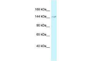 WB Suggested Anti-DHX38 Antibody Titration: 1. (DHX38 抗体  (Middle Region))