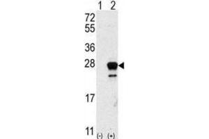 Western Blotting (WB) image for anti-GTPase NRas (NRAS) antibody (ABIN5023677) (GTPase NRas 抗体)