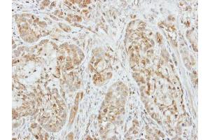 IHC-P Image Immunohistochemical analysis of paraffin-embedded A549 xenograft, using Factor X, antibody at 1:500 dilution.