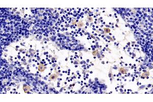 Detection of TLR5 in Rat Lymph node Tissue using Monoclonal Antibody to Toll Like Receptor 5 (TLR5) (TLR5 抗体  (AA 693-858))