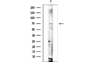 anti-Phospholipase A2-Activating Protein (PLAA) antibody