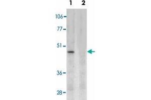 Western blot analysis of CD209 expression in human placenta tissue lysate in the absence (lane 1) and presence (lane 2) of blocking peptide with CD209 polyclonal antibody  at 2 ug /mL . (DC-SIGN/CD209 抗体  (Internal Region))