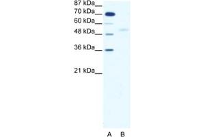 Western Blotting (WB) image for anti-SMAD, Mothers Against DPP Homolog 5 (SMAD5) antibody (ABIN2460352) (SMAD5 抗体)