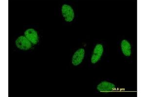 Immunofluorescence of monoclonal antibody to PHIP on HeLa cell. (PHIP 抗体  (AA 1599-1705))