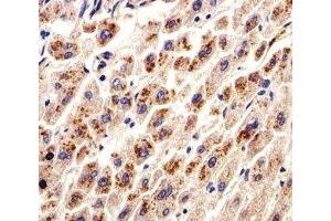 IHC analysis of FFPE human liver section using DHFR antibody; Ab was diluted at 1:25. (Dihydrofolate Reductase 抗体  (AA 1-50))