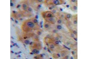 IHC-P analysis of Liver tissue, with DAB staining. (IL1R1 抗体  (AA 20-338))