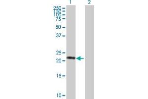 Western Blot analysis of VASH1 expression in transfected 293T cell line by VASH1 MaxPab polyclonal antibody. (VASH1 抗体  (AA 1-204))