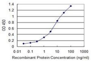 Detection limit for recombinant GST tagged LRRK1 is 0. (LRRK1 抗体  (AA 560-659))