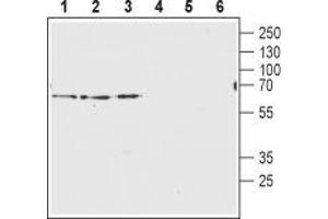 Western blot analysis of rat brain membranes (lanes 1 and 4), mouse brain membranes (lanes 2 and 5) and human U-87 MG glyoblastoma lysates (lanes 3 and 6): - 1-3. (SLC32A1 抗体  (Cytosolic, N-Term))