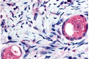 Human Ovary, Oocytes (formalin-fixed, paraffin-embedded) stained with TMEM5 antibody ABIN213420 at 5 ug/ml followed by biotinylated goat anti-rabbit IgG secondary antibody ABIN481713, alkaline phosphatase-streptavidin and chromogen. (TMEM5 抗体  (Extracellular Domain))