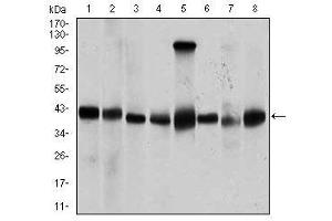 Image no. 2 for anti-Protein Phosphatase, Mg2+/Mn2+ Dependent, 1A (PPM1A) antibody (ABIN1491178) (PPM1A 抗体)