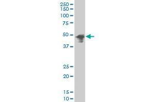 THRA polyclonal antibody (A01), Lot # 051003JC01 Western Blot analysis of THRA expression in MCF-7 (THRA 抗体  (AA 87-178))