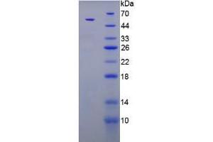 SDS-PAGE analysis of Rat Parathyroid Hormone Protein. (PTH 蛋白)