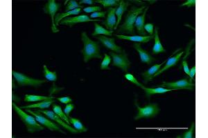 Immunofluorescence of purified MaxPab antibody to SRP19 on HeLa cell. (SRP19 抗体  (AA 1-144))