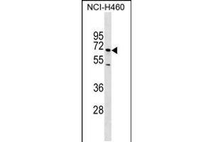 Western blot analysis in NCI-H460 cell line lysates (35ug/lane). (Selectin E/CD62e 抗体)