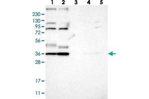 Western blot analysis of Lane 1: RT-4, Lane 2: U-251 MG, Lane 3: Human Plasma, Lane 4: Liver, Lane 5: Tonsil with YIPF2 polyclonal antibody  at 1:250-1:500 dilution. (YIPF2 抗体)