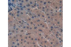IHC-P analysis of liver tissue, with DAB staining. (GTF2H5 抗体  (AA 1-71))
