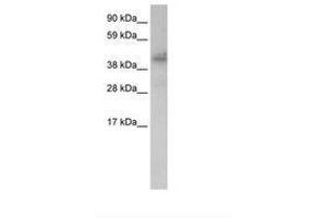 Image no. 1 for anti-Zinc Finger Protein 620 (ZNF620) (AA 361-410) antibody (ABIN203126) (ZNF620 抗体  (AA 361-410))