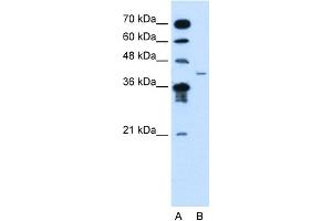 WB Suggested Anti-MFAP3L Antibody Titration:  2. (MFAP3L 抗体  (N-Term))
