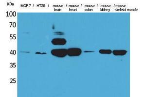 Western Blotting (WB) image for anti-Isocitrate Dehydrogenase 3 (NAD+) alpha (IDH3A) (Internal Region) antibody (ABIN3178348) (IDH3A 抗体  (Internal Region))
