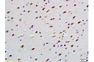 Formalin-fixed and paraffin embedded rat brain labeled with Anti-TUBB3 Polyclonal Antibody, Unconjugated  at 1:200 followed by conjugation to the secondary antibody and DAB staining (TUBB3 抗体  (AA 401-450))