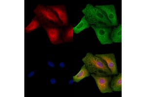 ABIN6257242 and ABIN6273630 staining  cells by IF/ICC. (GRIP1 抗体  (Internal Region))