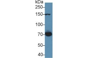 Detection of THBS1 in Rat Serum using Polyclonal Antibody to Thrombospondin 1 (THBS1) (Thrombospondin 1 抗体  (AA 71-259))