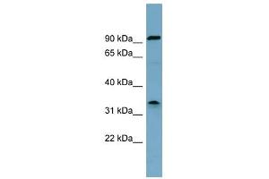 SDS antibody used at 1 ug/ml to detect target protein. (serine Dehydratase 抗体  (Middle Region))
