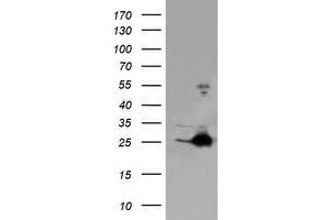 Image no. 1 for anti-Fetal and Adult Testis Expressed 1 (FATE1) antibody (ABIN1498221) (FATE1 抗体)