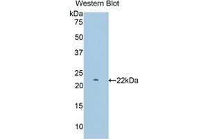 Detection of Recombinant PYGM, Mouse using Polyclonal Antibody to Glycogen Phosphorylase, Muscle (PYGM) (PYGM 抗体  (AA 11-187))