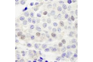 anti-Integrator Complex Subunit 4 (INTS4) (AA 913-963) antibody