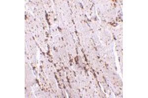 Immunohistochemistry of SCARB2 in human skeletal muscle with SCARB2 polyclonal antibody  at 2. (SCARB2 抗体  (Internal Region))