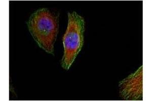 Image no. 1 for anti-Mitogen-Activated Protein Kinase 1/3 (MAPK1/3) (pThr185), (pTyr202) antibody (ABIN196998) (ERK1/2 抗体  (pThr185, pTyr202))