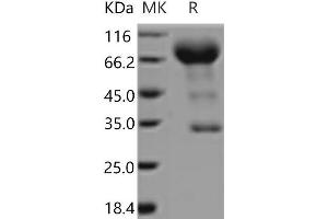 Western Blotting (WB) image for Prominin 1 (PROM1) protein (Fc Tag) (ABIN7321129) (CD133 Protein (Fc Tag))