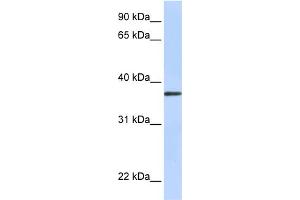 WB Suggested Anti-TTMB Antibody Titration:  0. (TMEM200B 抗体  (N-Term))