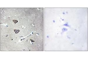 Immunohistochemistry analysis of paraffin-embedded human brain tissue, using 5-HT-2C Antibody. (HTR2C 抗体  (AA 161-210))