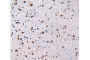 Used in DAB staining on fromalin fixed paraffin- embedded spinal cord tissue
