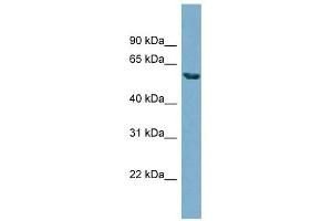 HHAT antibody used at 1 ug/ml to detect target protein. (HHAT 抗体  (N-Term))