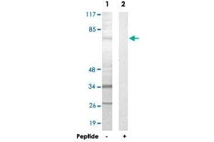 Western blot analysis of extracts from HepG2 cells, using FASTKD3 polyclonal antibody . (FASTKD3 抗体)